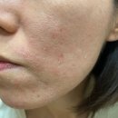 자명약국 | 피부장벽 회복 크림 역시 의사크림은 다르네요