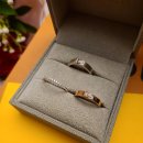 세려메디칼 | [리브레아뜨]웨딩밴드 드디어 받았어용!!!