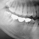 우리교정치과기공소 이미지