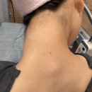 수원역광장 한의원 티스토리