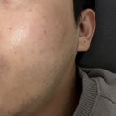 여우야카페<에이피 뷰티 ◆ 듀얼 리페어 리프트 크림 마스크>당첨후기