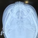 더강추정형외과의원 이미지