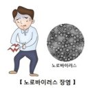 노로바이러스 이미지