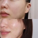 더리턴피부과의원 | 신논현피부과 리턴셀 줄기세포 스킨부스터 후기