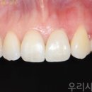 치아사랑치과기공소 이미지