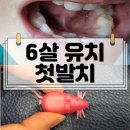 동탄스타치과의원 네이버블로그
