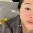 을지로입구역(2) 화장실 | 통증없는 심부볼 온다 리프팅 잘하는곳 을지로입구역피부과 후기