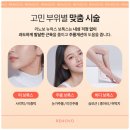 리노보의원 이미지