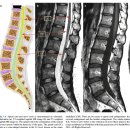 정상 척추사진 MRI - 정리해야.. 이미지