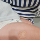 하은약국 | 천안 최재혁소아과에서 아기 4개월 접종 맞은 후기(Feat. 천상우원장님 4개월 아기 코 그렁그렁 진료)