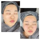 부산 양정 피부관리 에르에스테틱 리쥬스템셀 관리 후기