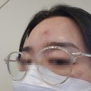 라엘라의원 | [일상] 라엘라에서 피부관리하기 FCR(산호필링) 더마샤인 사이토베지클