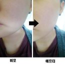더페이스샵 치아씨드 사용 후기.