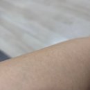 권의원 | 신촌 레이저제모 성지 '노벨의원' 제모 5회차 내돈내산 후기