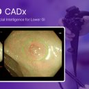 아이넥스 이미지