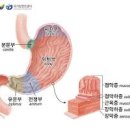 위암 3기 4기 위암 말기 위암 병기 생존율 위암치료 위암 발생 원인 증상 이미지