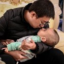 쉬 웨이, ‘멘케스 증후군’ 2살 아들 위해 ‘구리 히스타딘’ 제조(멘케스병(Menkes disease)) 이미지