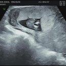 정성일산부인과의원 이미지