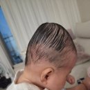 NR-1[경수대로]-상-5 | 이노야드수원 7개월 아기 단두교정 후기, 10만원 할인코드 및 최대 할인 꿀팁