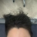 지에스25 보라매타워점 | 피부윤곽관리 리프팅 보라매에스테틱 단한번만해도 ! 디또뷰티보라매점