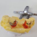 다윗치과기공소 이미지