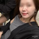 인디언 | 을지로피부과 쥬베룩볼륨 인디언밴드 시술 후기