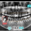 은천동-46 네이버블로그