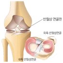 조은손병원 | 반월상 연골 파열의 원인 과 치료후기