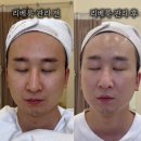 퓨어에스테틱 이미지