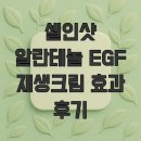 크림 | 셀인샷 알란테놀 EGF 재생크림 효과 후기