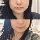 잠실 헤드 스파부터 얼굴 리프팅 라인까지 세심한 케어 후기ㅣ오늘뷰티 헤드스파 &amp;에스테틱 잠실점