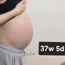 미래종합가스 | [출산기록] 광명 미래여성산부인과 제왕절개 후기