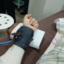 통영종로마취통증의학과의원 | 손 다한증 보톡스 치료 후기 (실비 가능 병원)