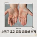 성모어린이집 | 수족구 초기 증상 고열 예방 부산성모병원 응급실 후기