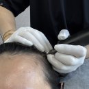 헤어라인 | 청주SMP studio 헤어라인 커버 후기