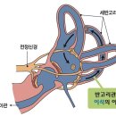 독일탑보청기 이미지
