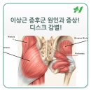 이상근 증후군이란 이미지