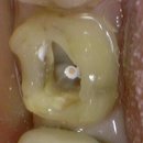 가온치과기공소 이미지