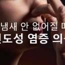 입 냄새 안 없어질 때 이미지