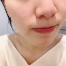 수영로 325번길 | 대연피부관리 추천｜올가드림뷰티 대연점 모공디톡스 후기