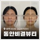세연윤곽체형연구소 | 평택 피부관리 맛집 '동안비결뷰티' 작은 얼굴 윤곽관리로 체형교정까지!