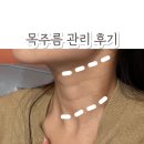 리지에스테틱 | 분당피부관리 / 선천성 목주름 관리 케어 리얼 변화 후기 - 리지에스테틱