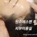 에스엔투