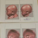 11500-19-41-10 | 오쏘코리아 할인 추천인코드 (41/9#473)두상교정헬멧 오쏘코리아 헬멧 치료 종료 6개월 경과 후기