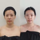 어나더 핸드 | 강남신부관리 얼굴 비대칭 교정, 논현경락 어나더핸드 7회차 내돈내산 후기