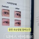 니어스 아이래쉬