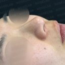 노즈랩의원 이미지