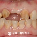 퍼펙트치과기공소 이미지