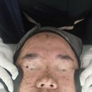 이마트24 다대푸르지오점 | “대구 동성로 피부관리 가꾸다, 예민피부도 OK였던 알지필링 솔직후기!”