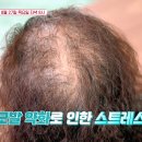모발 약화는 모두가 두려워하는 문제! 이미지